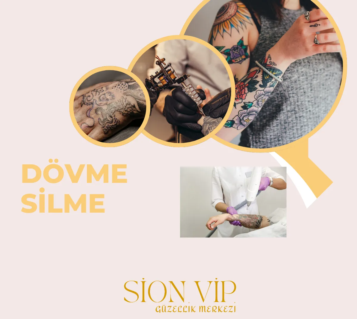 Dövme Silme